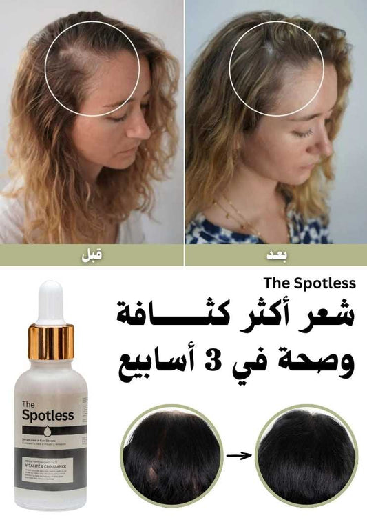 Spotless سيروم ضد تساقط الشعر